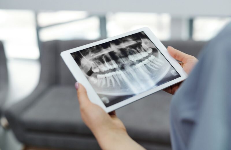 Hands holding a tablet with a dental X-ray, the practice blurred behind