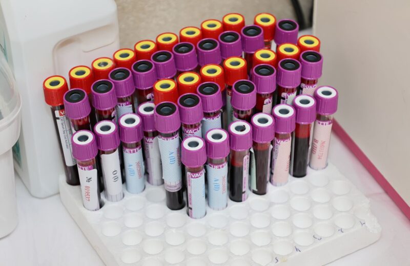 Blood sample tubes with purple and red caps in a white rack